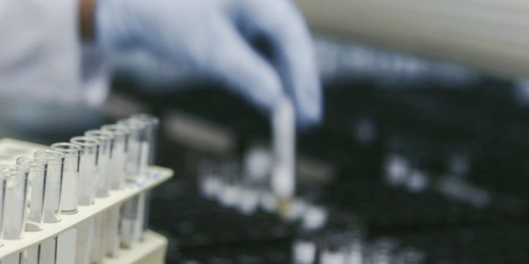 USDA’s National Veterinary Services Laboratory recently confirmed the presence of highly pathogenic avian influenza for the first time in Benton and Clatsop counties